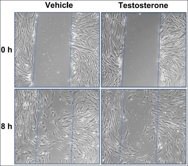 Wilhemson et al Endocrinology.jpg